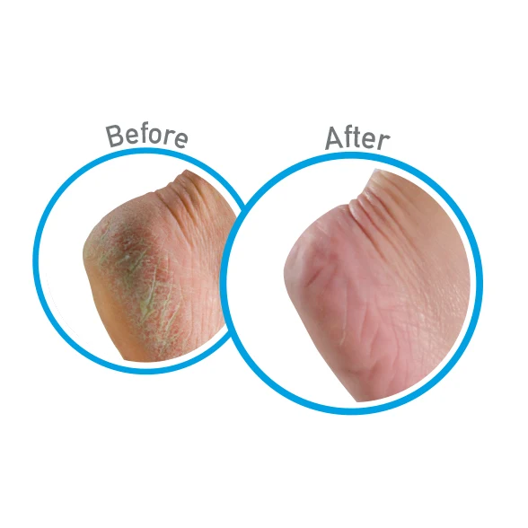 Healthy Feet Foot Cream Tube 3 oz K0280001 - Image 3